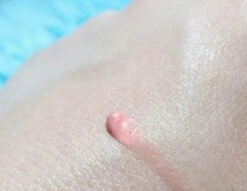 Biodermal Sun Lipbalm SPF25 - Tube 12 Ml - Natural Pink - Lippenbalsem -Beste Lip Winkel 1200x927 3